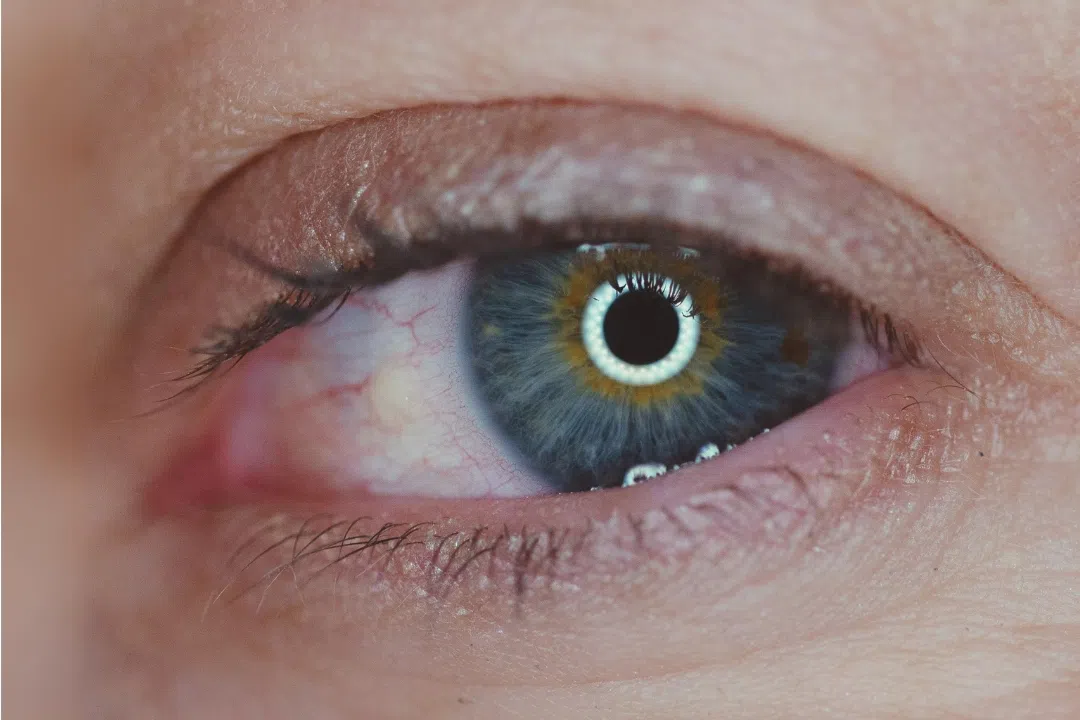 You are currently viewing Ablasi Retina: Ancaman Serius bagi Penglihatan dan Cara Menanganinya